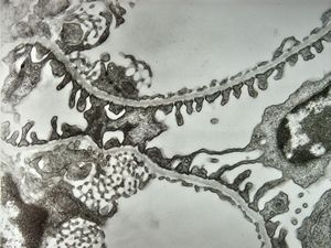 normal kidney - mouse(endothelium and podocytes)